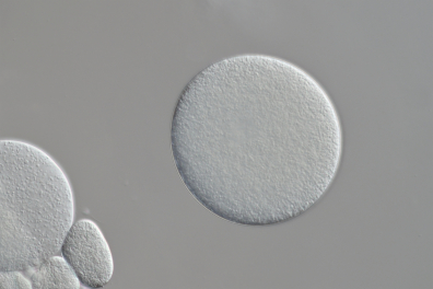 Ovule d'Oursin x100